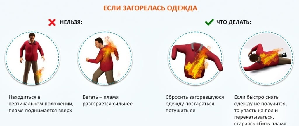 горит одежда